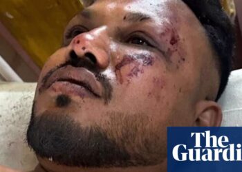 ‘I noticed folks dying in entrance of my eyes’: British survivor describes Air India crash | Air India Ahmedabad airplane crash