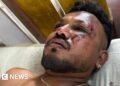 British passenger in seat 11A survives India aircraft crash, studies say