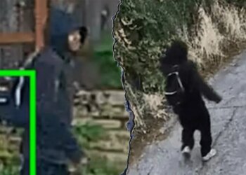 88-year-old lady hospitalized after finger bitten off in theft: police 88-year-old lady hospitalized after finger bitten off in theft: police