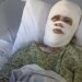 Chemical assault leaves Georgia girl hospitalized with third-degree burns Chemical assault leaves Georgia girl hospitalized with third-degree burns