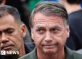 Brazil ex-president Bolsonaro’s surgical procedure for hernia ‘profitable’