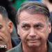 Brazil ex-president Bolsonaro’s surgical procedure for hernia ‘profitable’