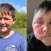 TikTok development leaves boy with extreme burns, docs concern warning