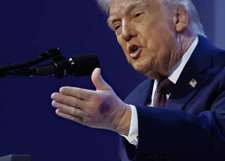 Donald Trump well being: On the president’s age, is he OK?