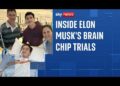 What it is prefer to trial Elon Musk’s mind chip