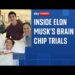 What it is prefer to trial Elon Musk’s mind chip