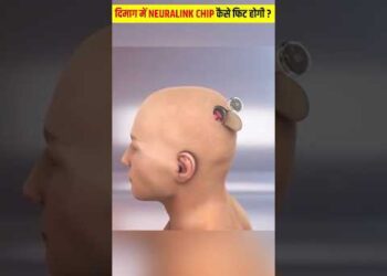 How Elon Musk’s Neuralink Mind Chip Works ?