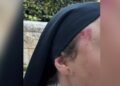 Man, 36, to be charged for assaulting French nun in Jerusalem